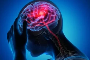 Memahami Perbedaan Stroke Ringan dan Serius: Panduan Lengkap